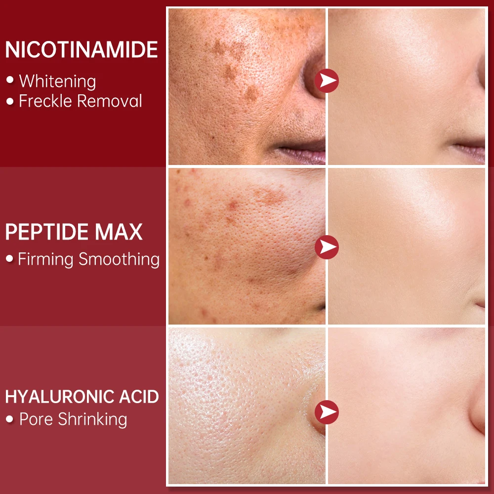 FORT PORE REFINING Serum Niacinamide & Glycolic Acid Serum for Glowing Skin Dark Spot Correcting Pore Refining Face Serum Skin Whitening Anti-Aging Glass Skin Care 30ml