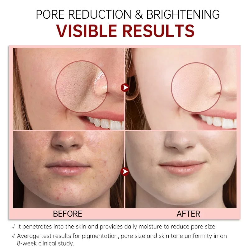 FORT PORE REFINING Serum Niacinamide & Glycolic Acid Serum for Glowing Skin Dark Spot Correcting Pore Refining Face Serum Skin Whitening Anti-Aging Glass Skin Care 30ml